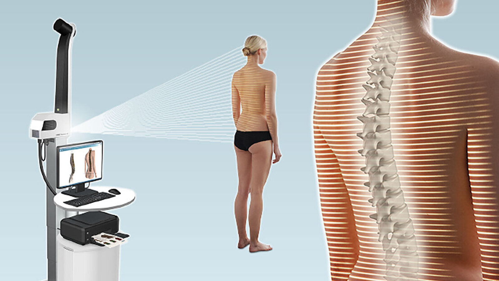 © DIERS International GmbH